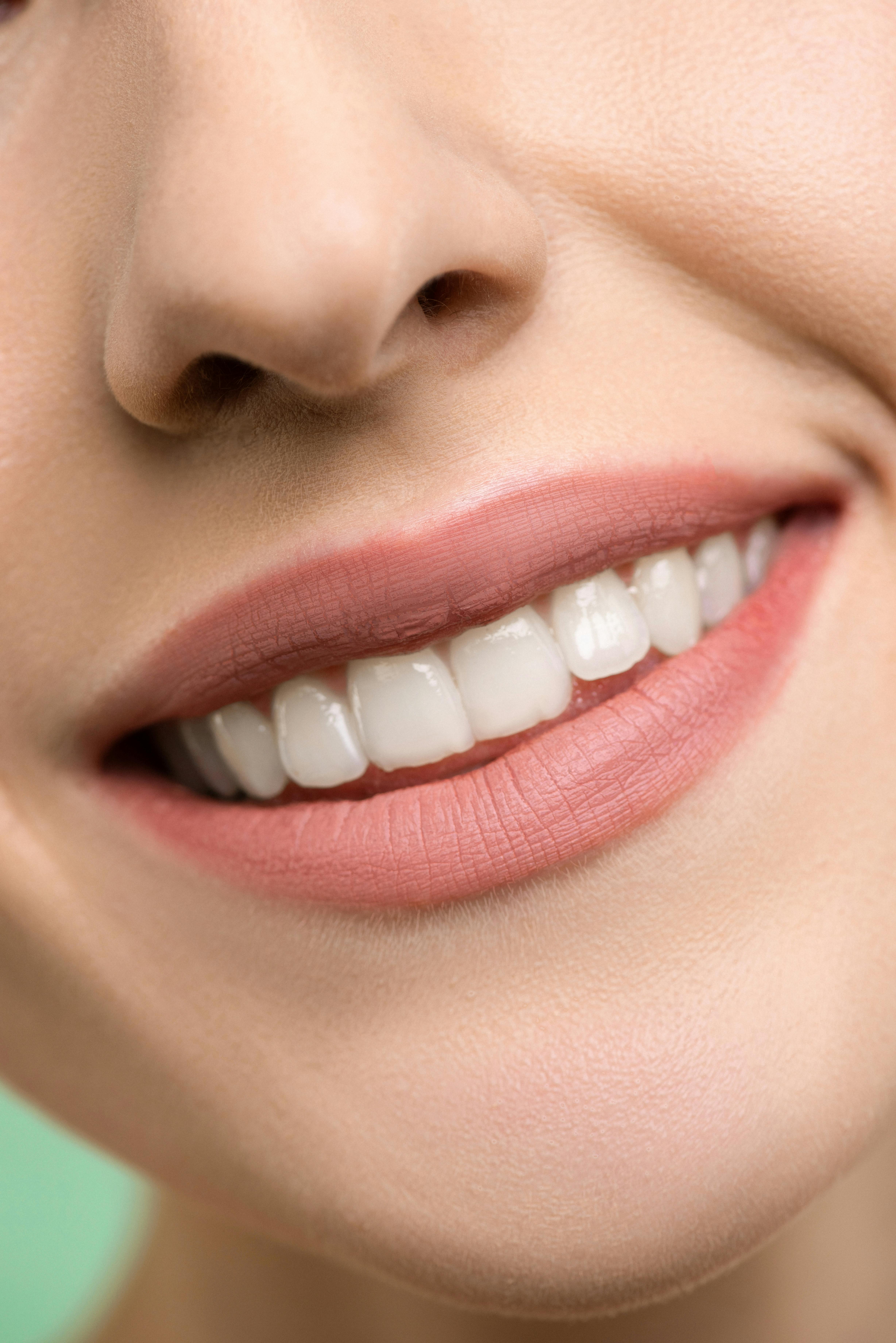teeth whitening for sensitive teeth