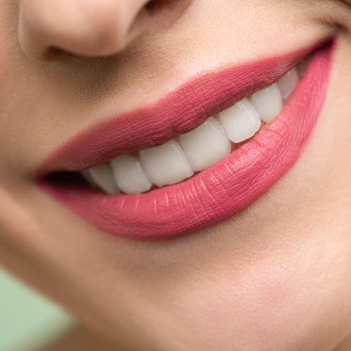 Resultado de tratamiento dental: sonrisa sana