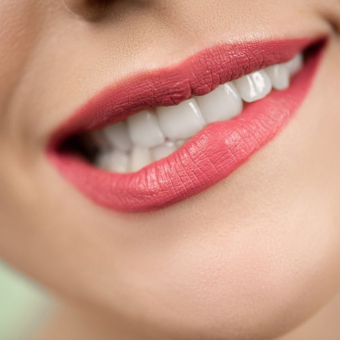 Resultado de tratamiento dental: sonrisa sana