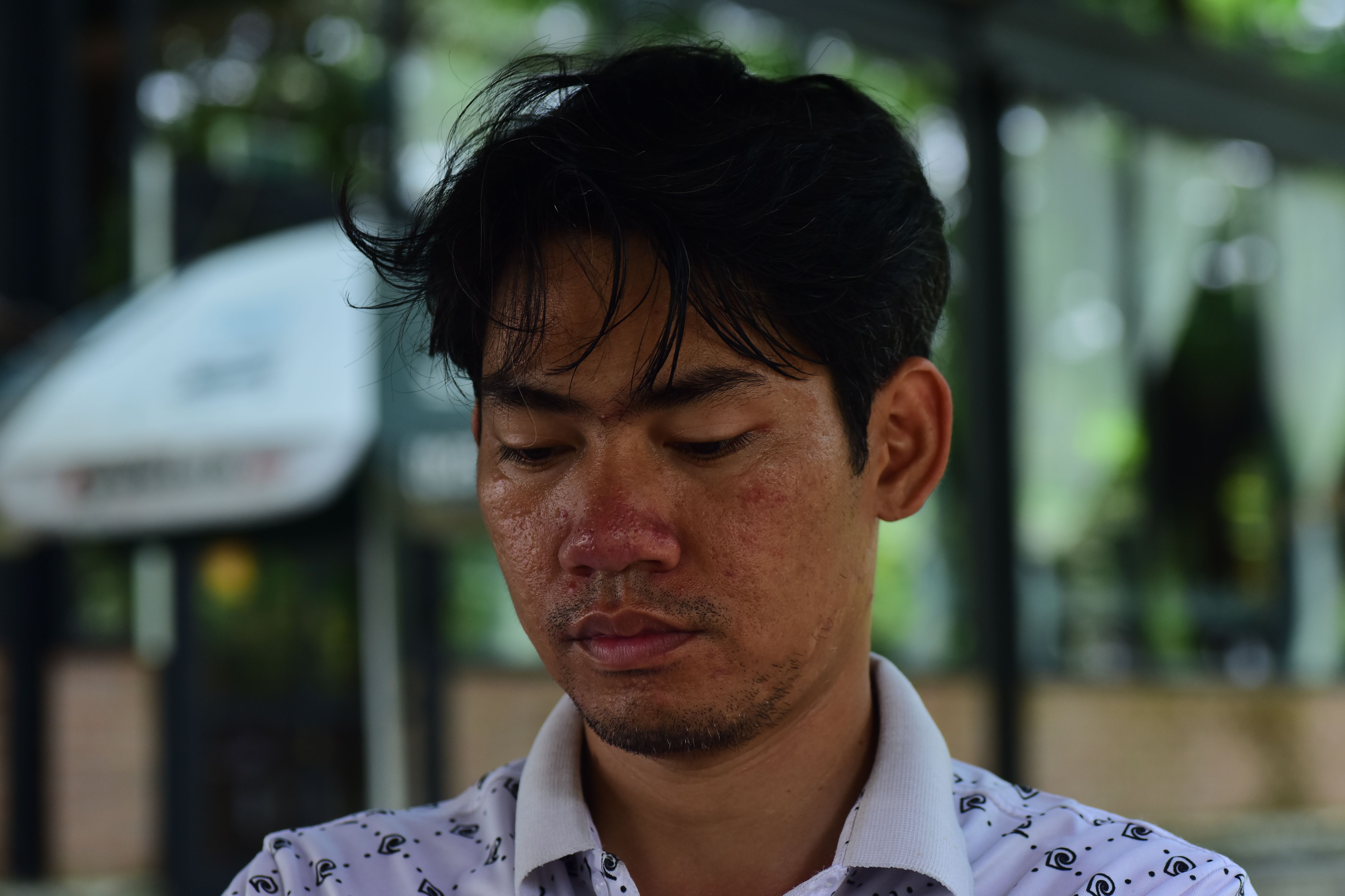 Khởi Tố "Cha Dượng" Bạo Hành Con Riêng Của Người Tình Ở Đồng Nai: Hé Lộ Chuỗi Ngày Đau Khổ Của Bé Gái 11 Tuổi