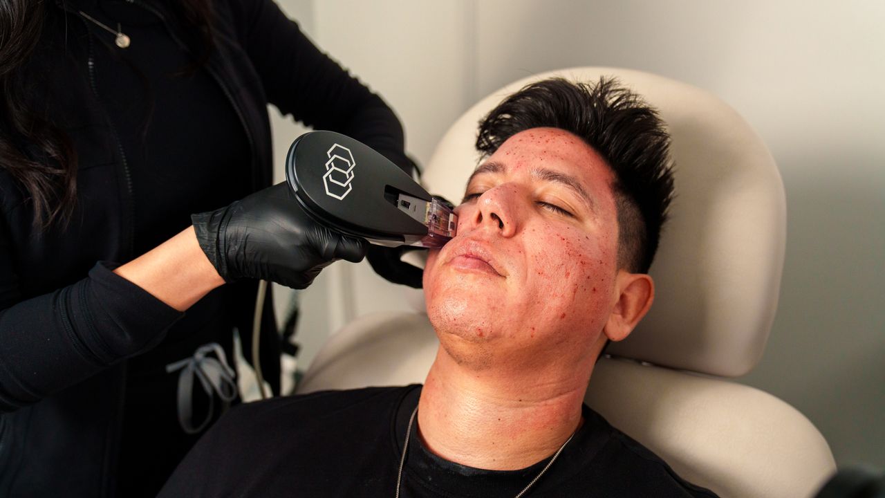 Renove Seu Sorriso: O Especialista em Preenchimento Código de Barras em Jaú - Augusta Perfection