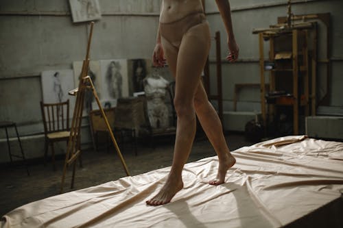 Woman With Vitiligo in Her Legs