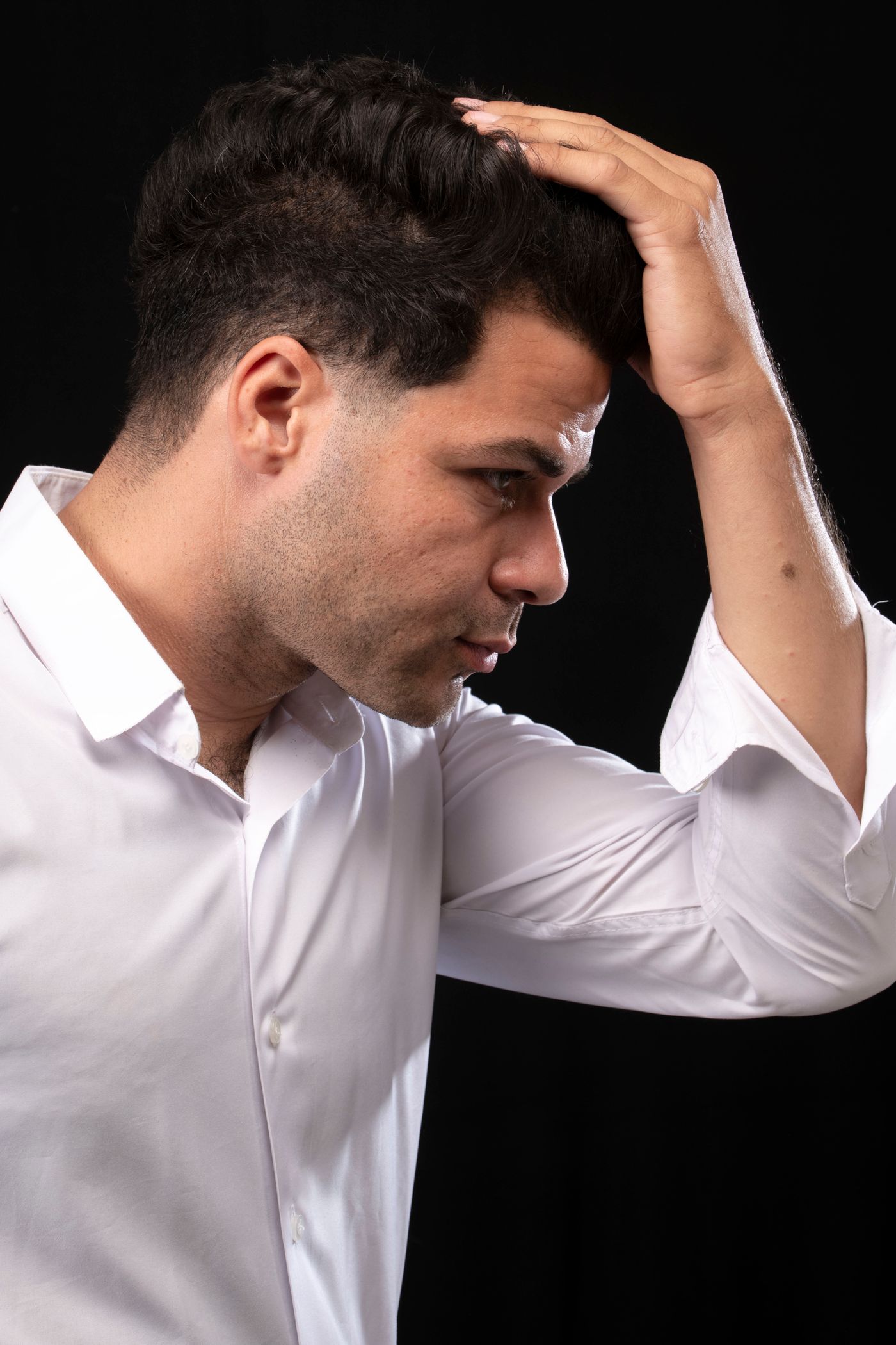 Checking a receding hairline and thinning hair