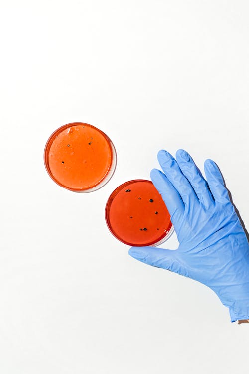 Person Holding Petri Dish
