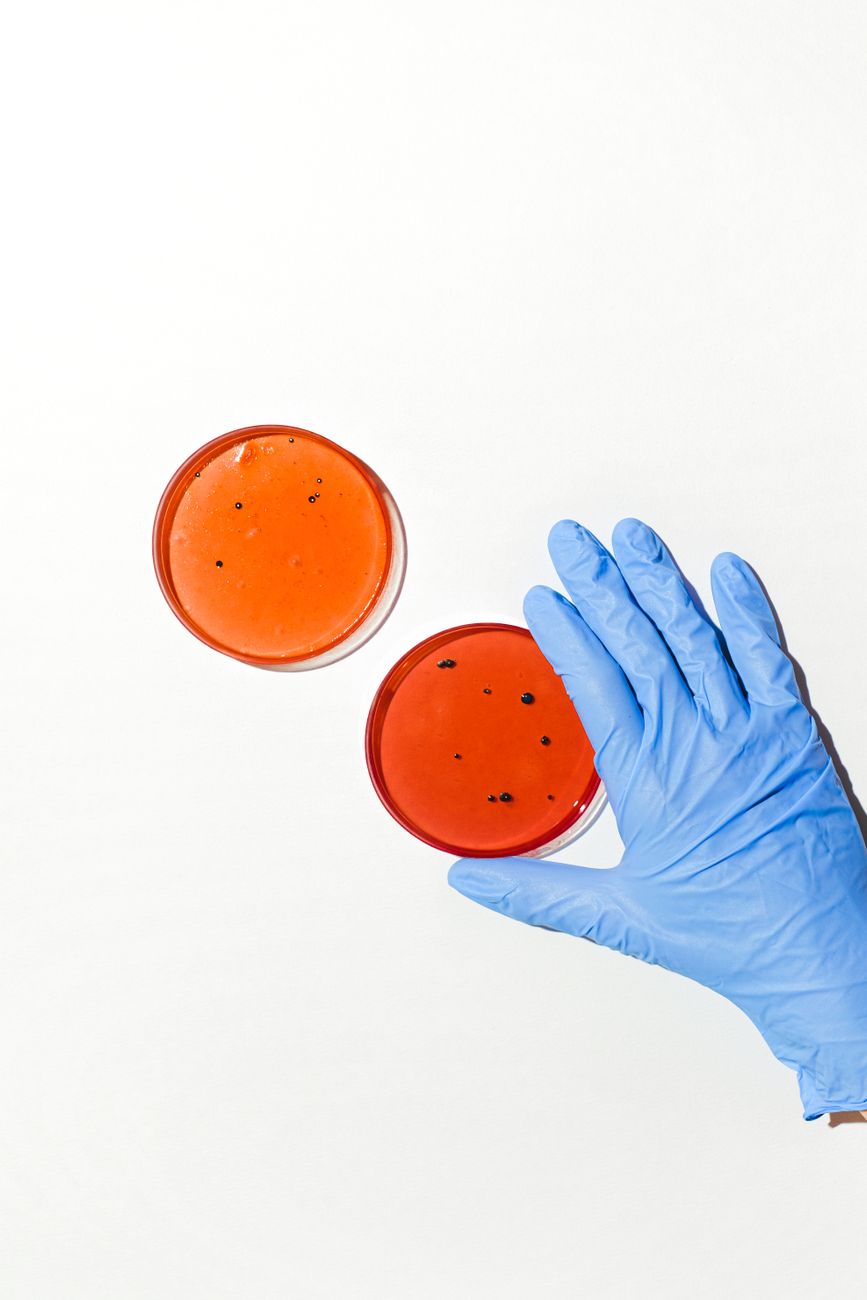 Gloved hands holding petri dishes during microbiology research, illustrating how microbial sampling shapes endocrine-bone studies.