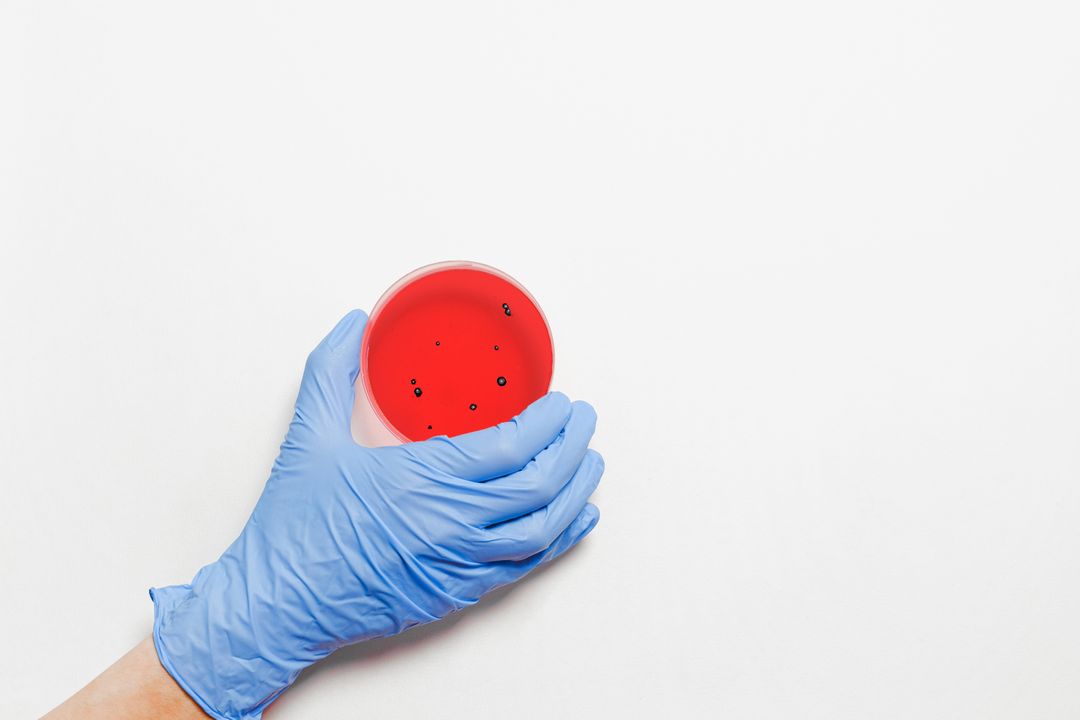 Gloved hand holding a red agar culture plate