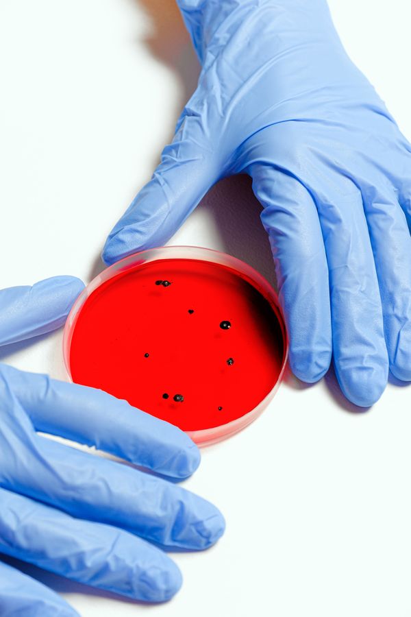 Petri Dish