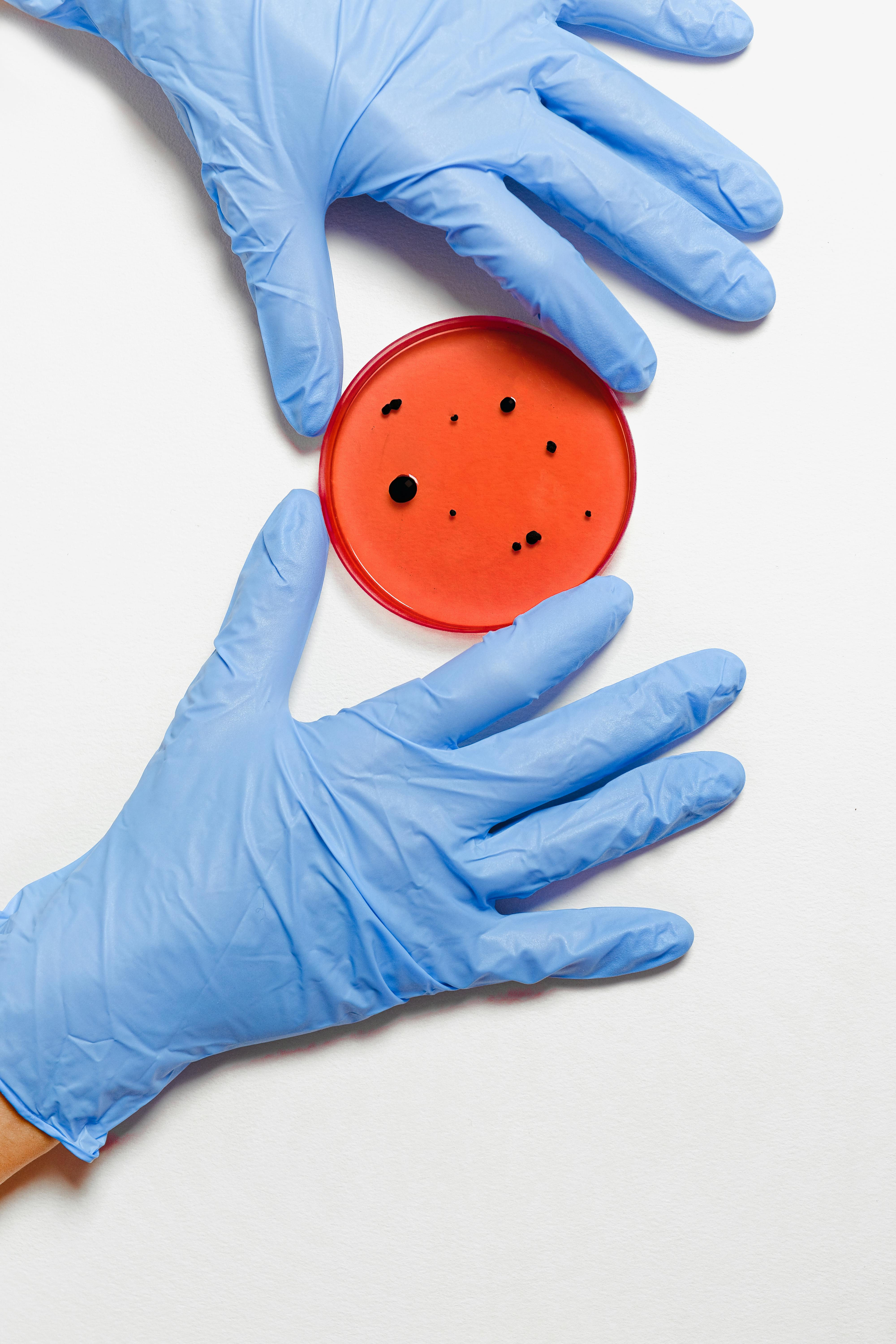 Scientist wearing blue gloves examines bacteria culture in a red petri dish in laboratory setting.