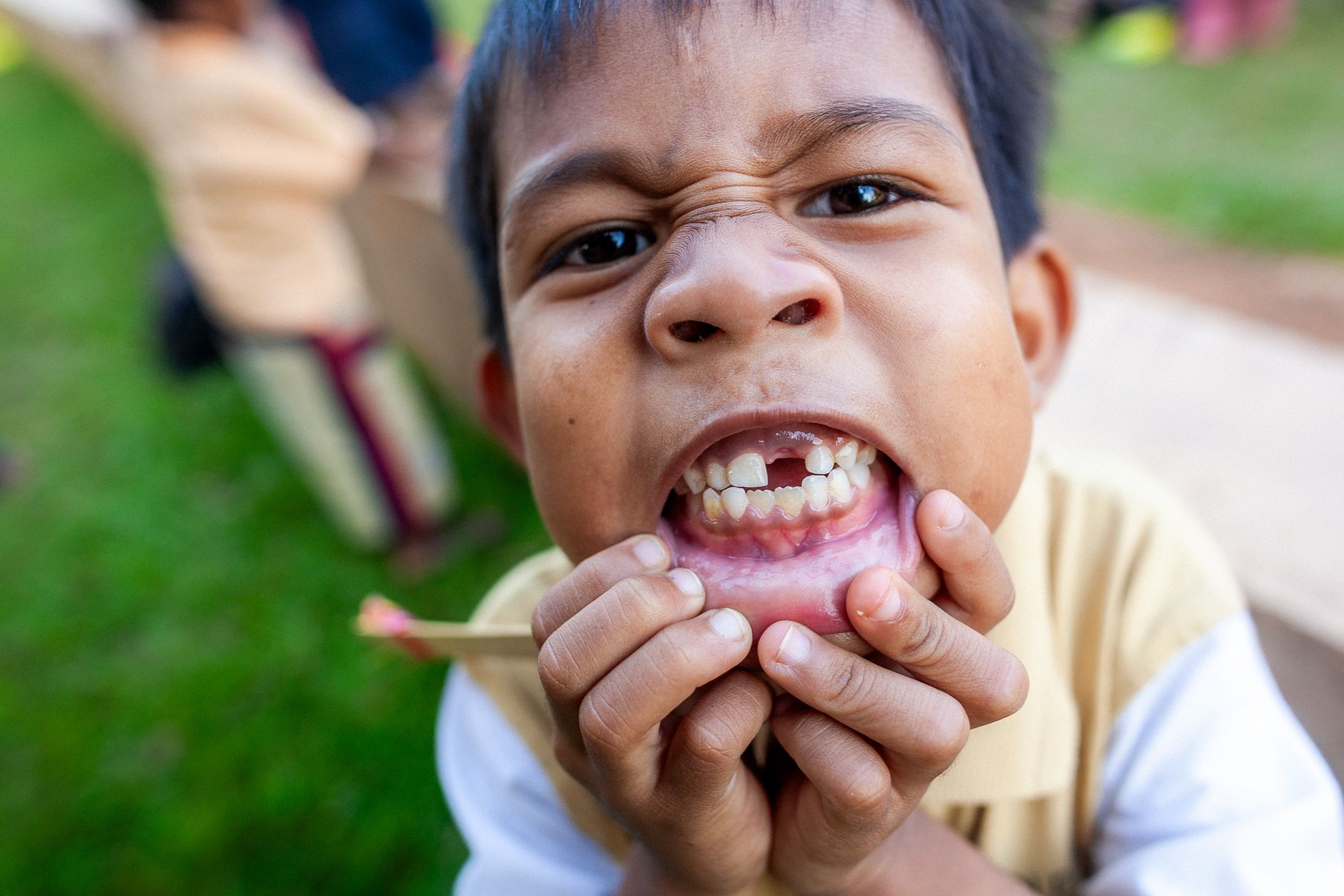 A young child outdoors making a funny face and showing a gap-toothed smile, emphasizing childhood playful moments.