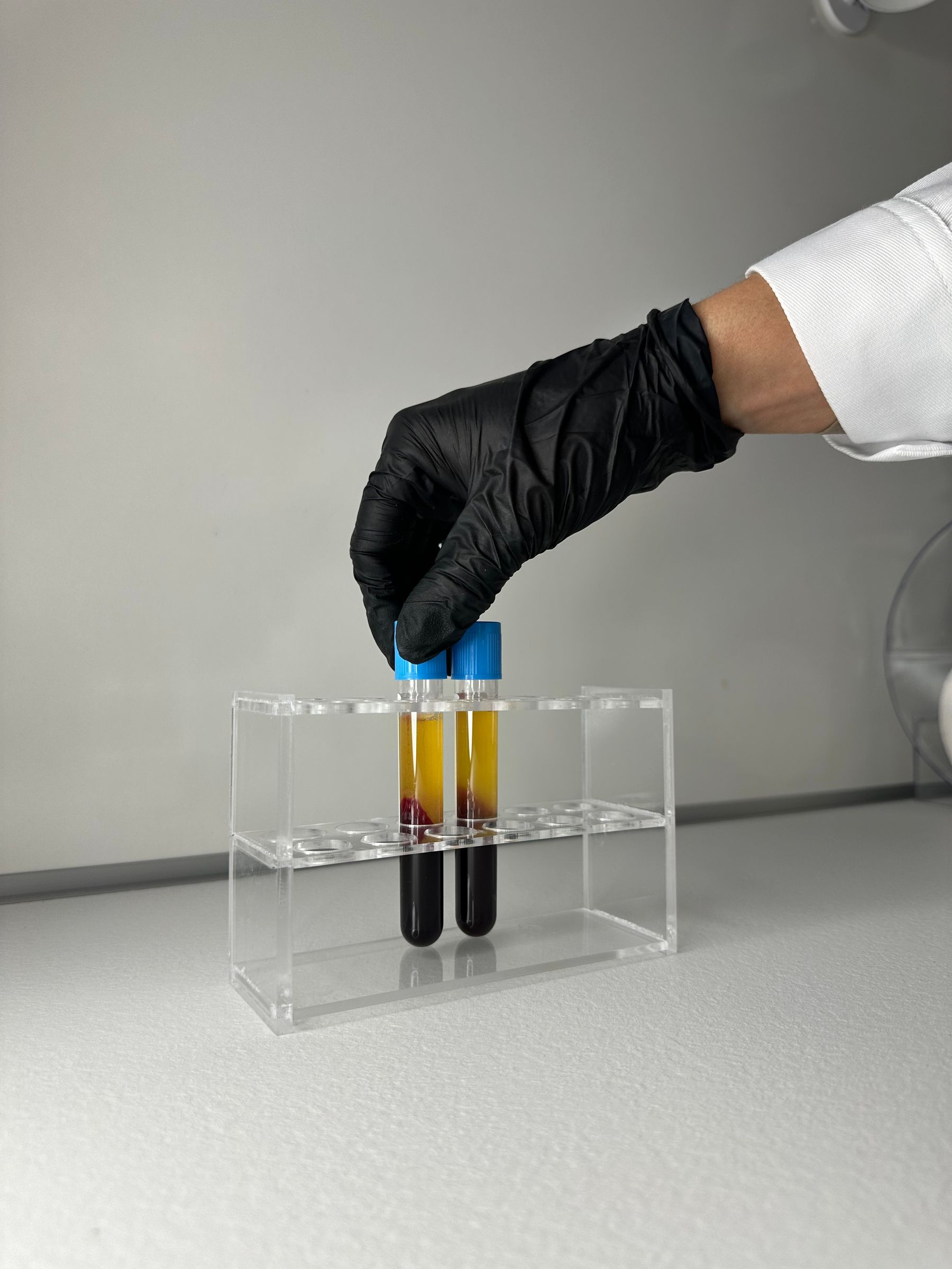 Close-up of organized blood sample tubes in a modern clinical laboratory