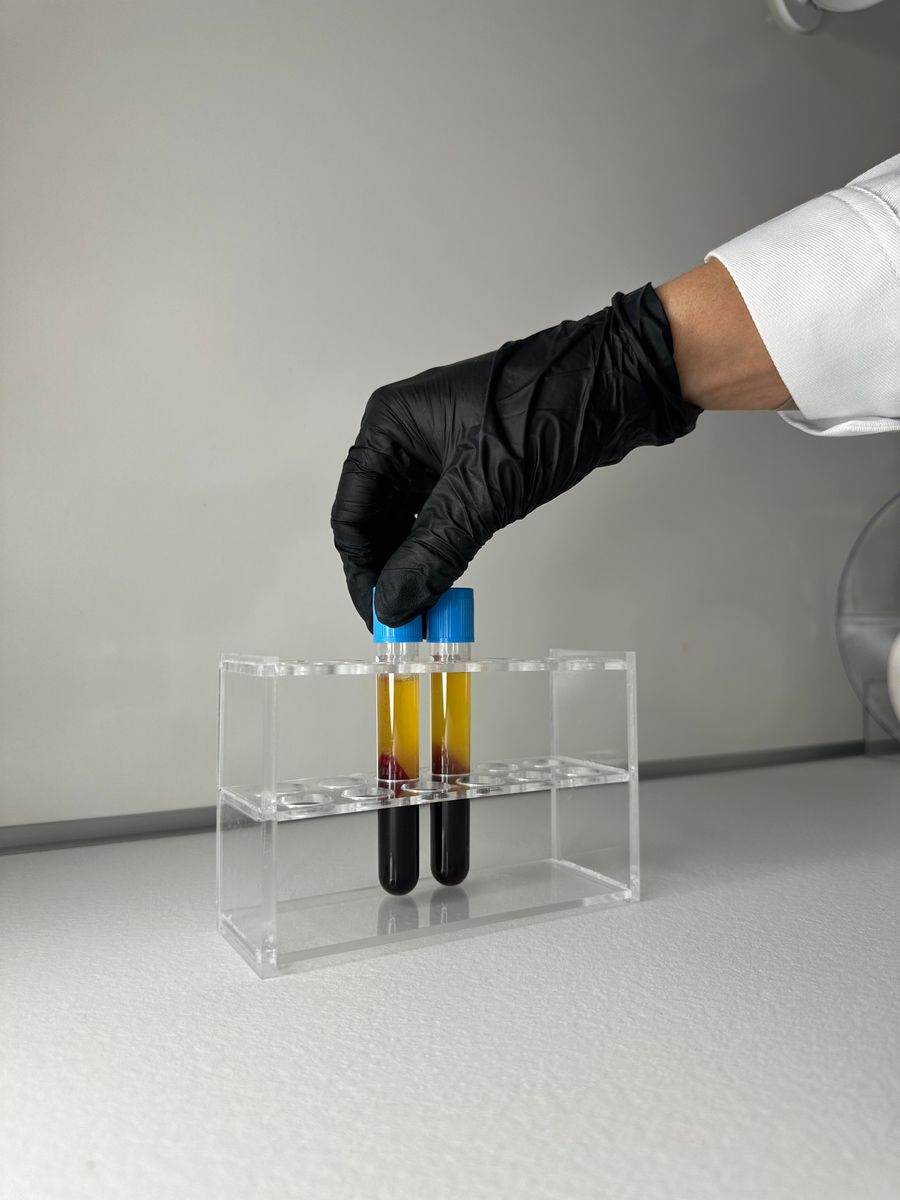 A gloved hand placing separated blood sample tubes into a rack
