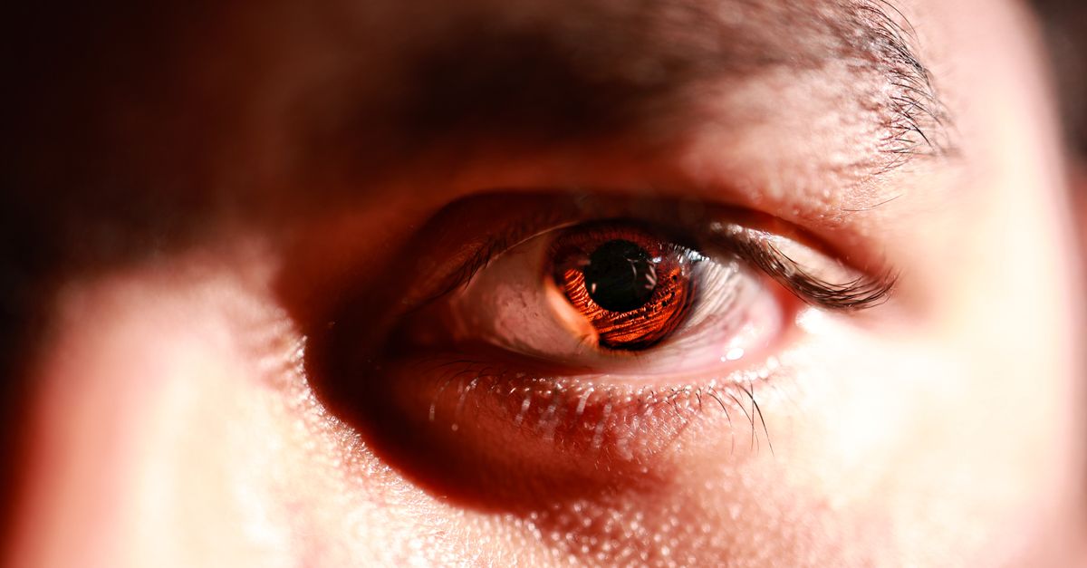 AIIMS Eye Bank Expands Cornea Retrieval Network with Three Hospitals