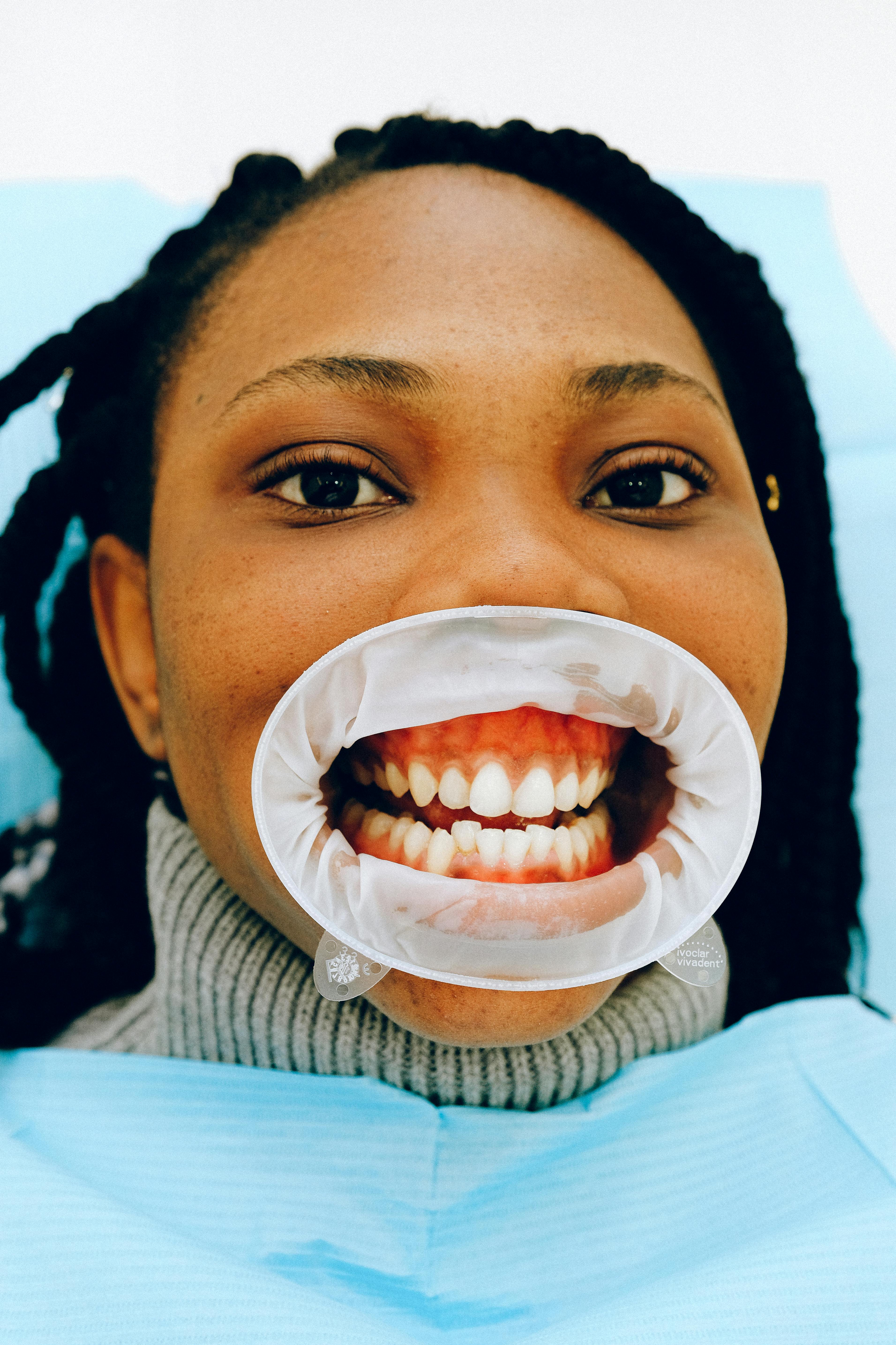 Female Ethnic Patient With Open Mouth In Dental Clinic Free Stock Photo   Pexels Photo 3845853 