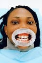 Female ethnic patient with open mouth in dental clinic