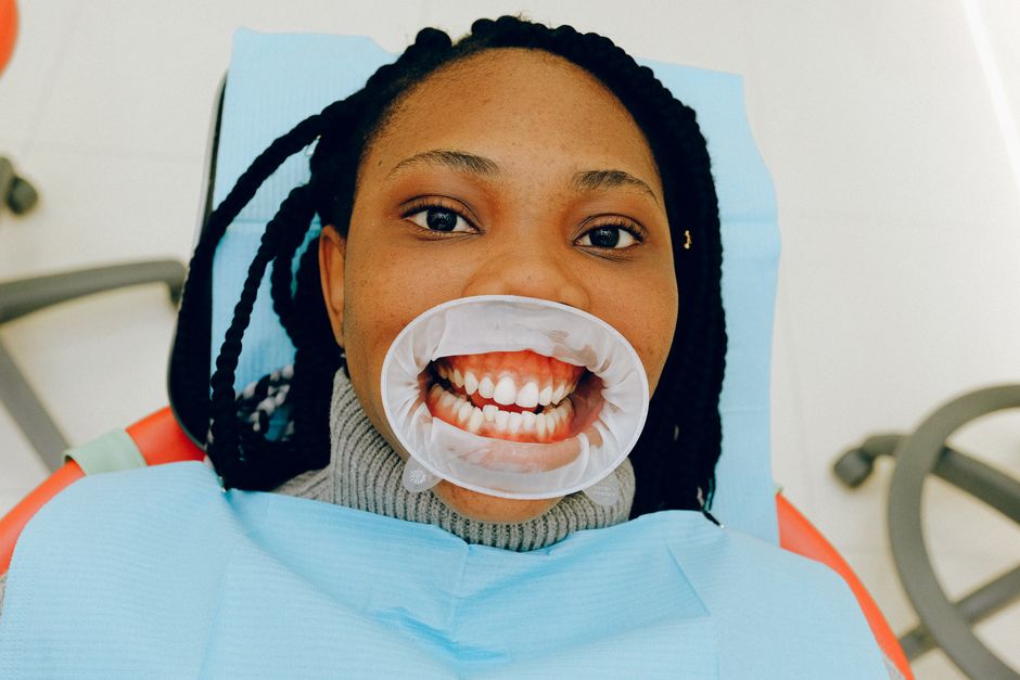 HSA whitening kit rules - Close-up of a woman during a dental exam with a cheek retractor.