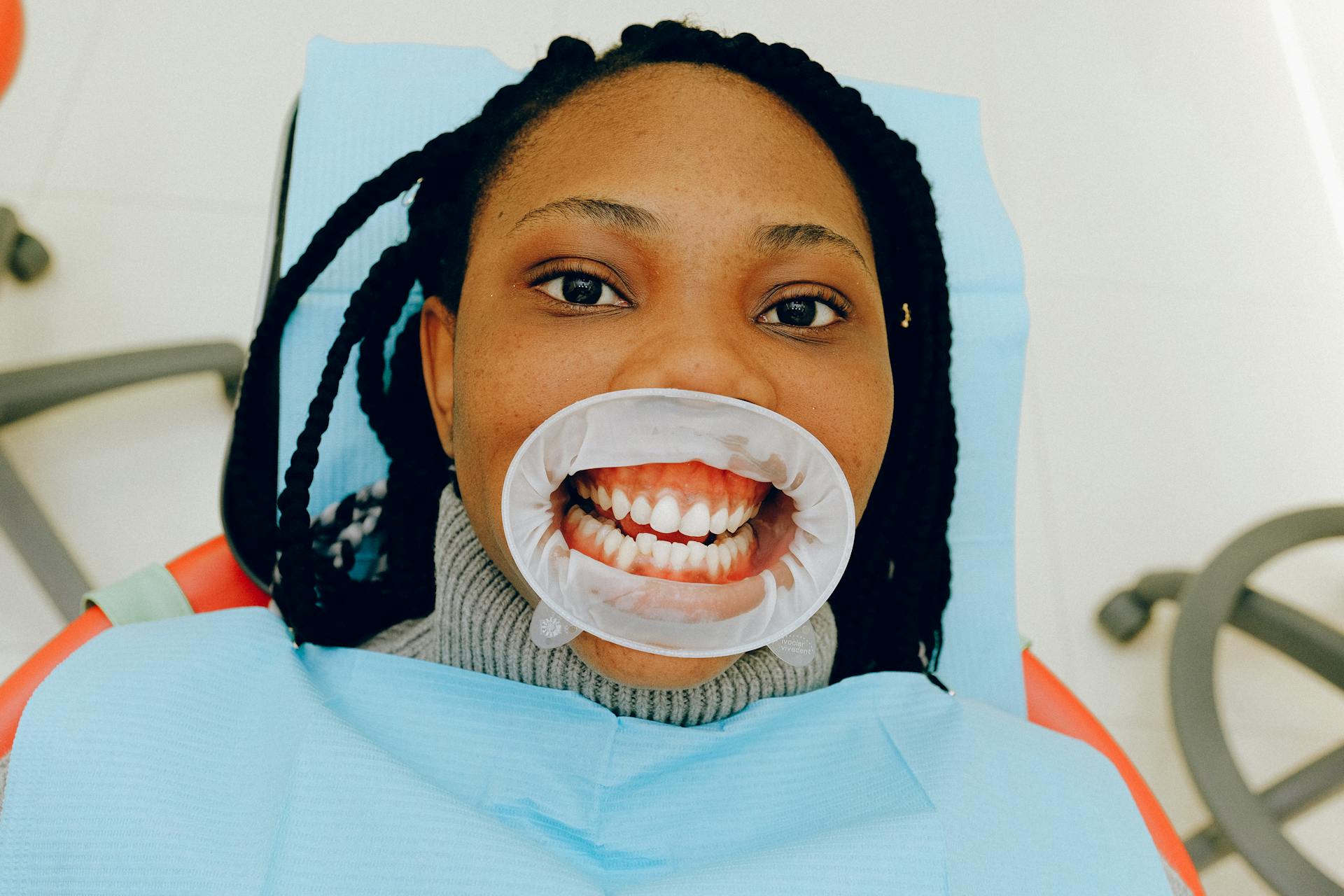 Woman with Dental Cheek Retractor