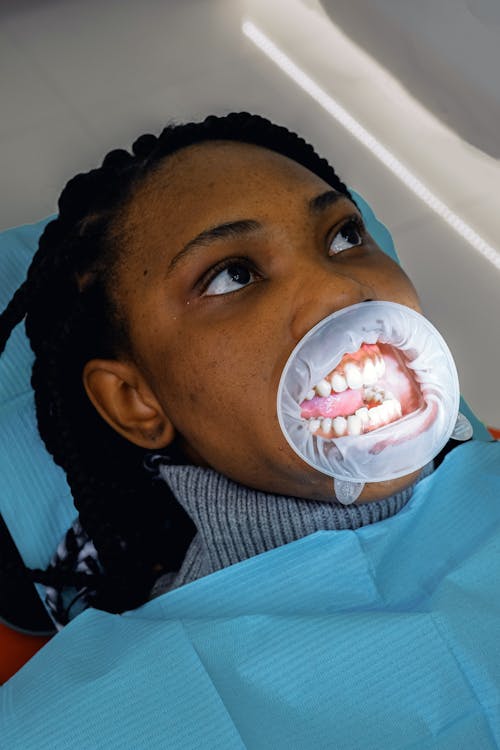 Young female ethnic patient with mouth expander during dental procedure in clinic