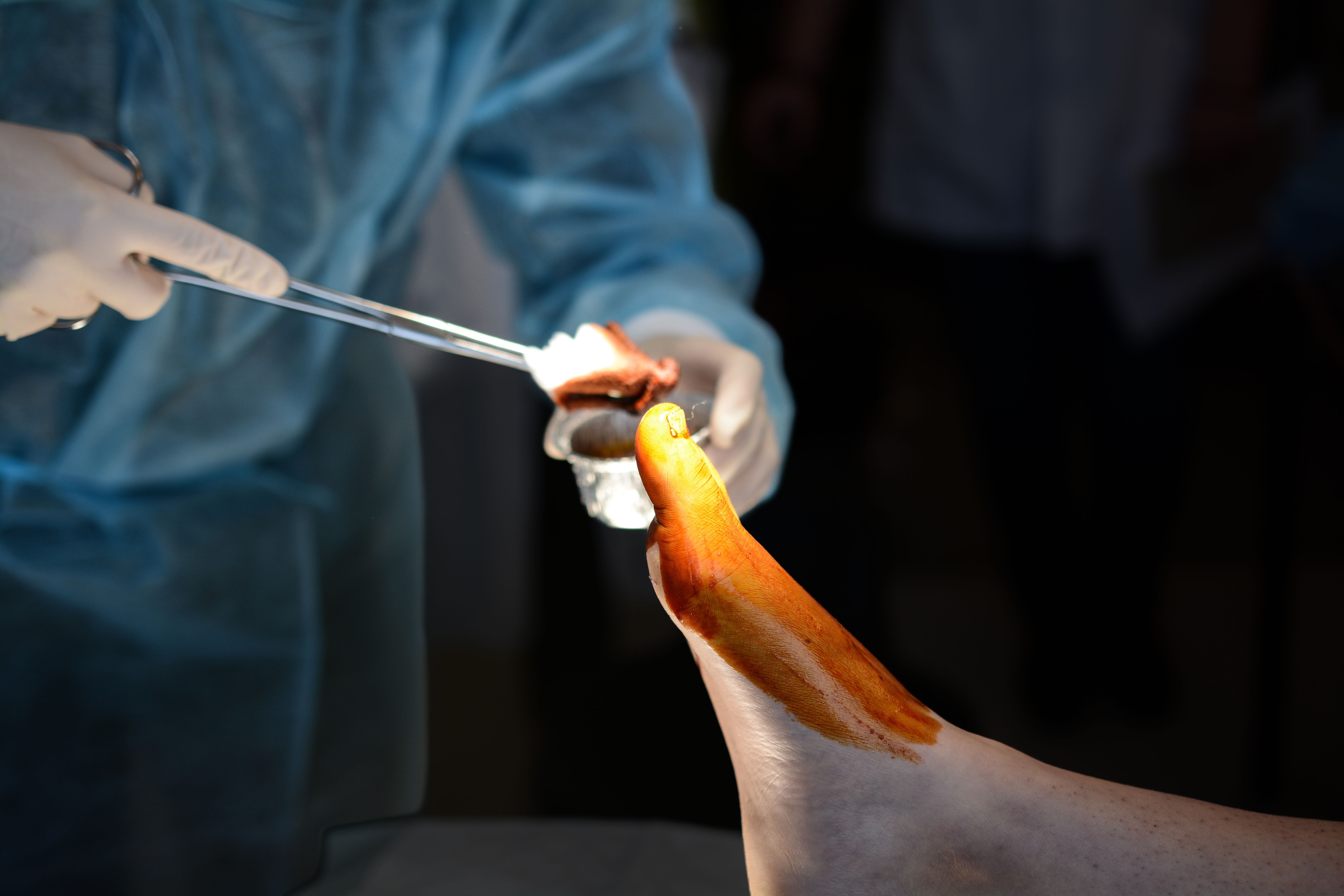 The Financial Implications of Robotic Surgery in US Hospitals