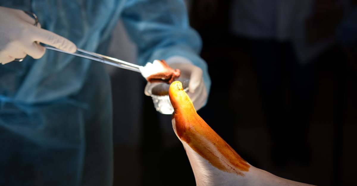 The Financial Implications of Robotic Surgery in US Hospitals