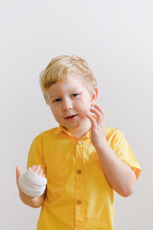 Free A cute young boy with a bandaged hand wearing a yellow shirt in a well-lit environment. Stock Photo