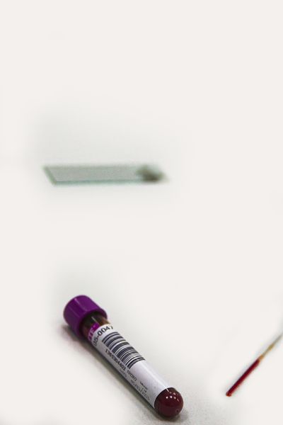 Blood test tube — anemia diagnosis