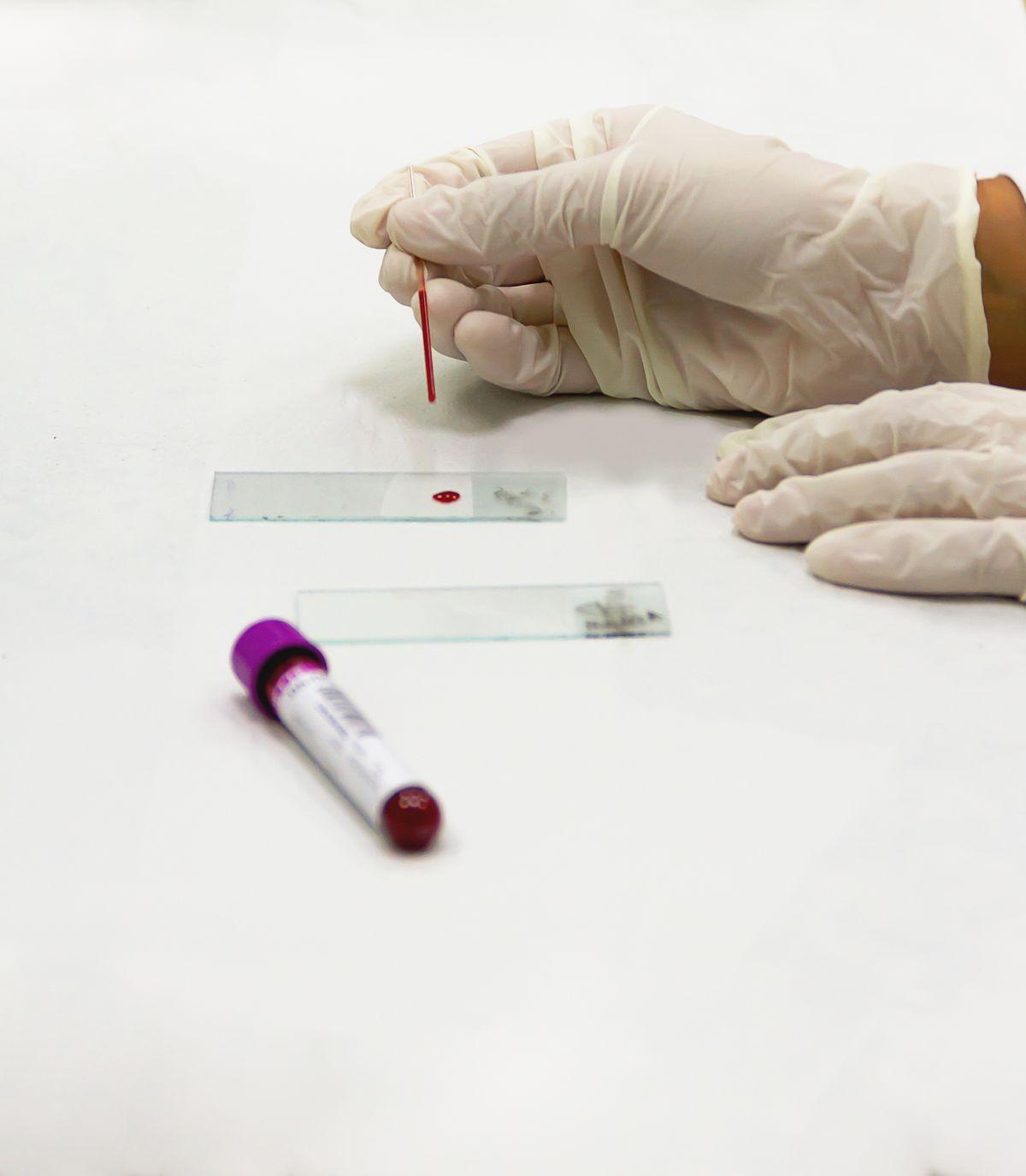 At-Home Sperm Test Kit