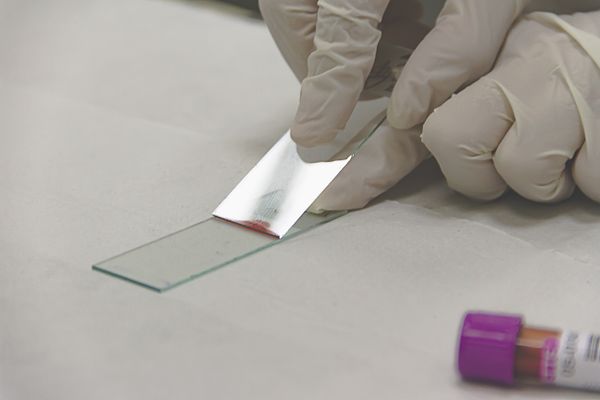Person holding slides - blood smear preparation