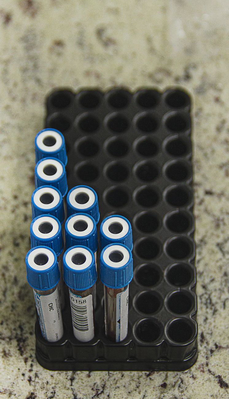 Why Multi-Cancer Early Screening is the Ultimate Diagnostic Audit for Your Body