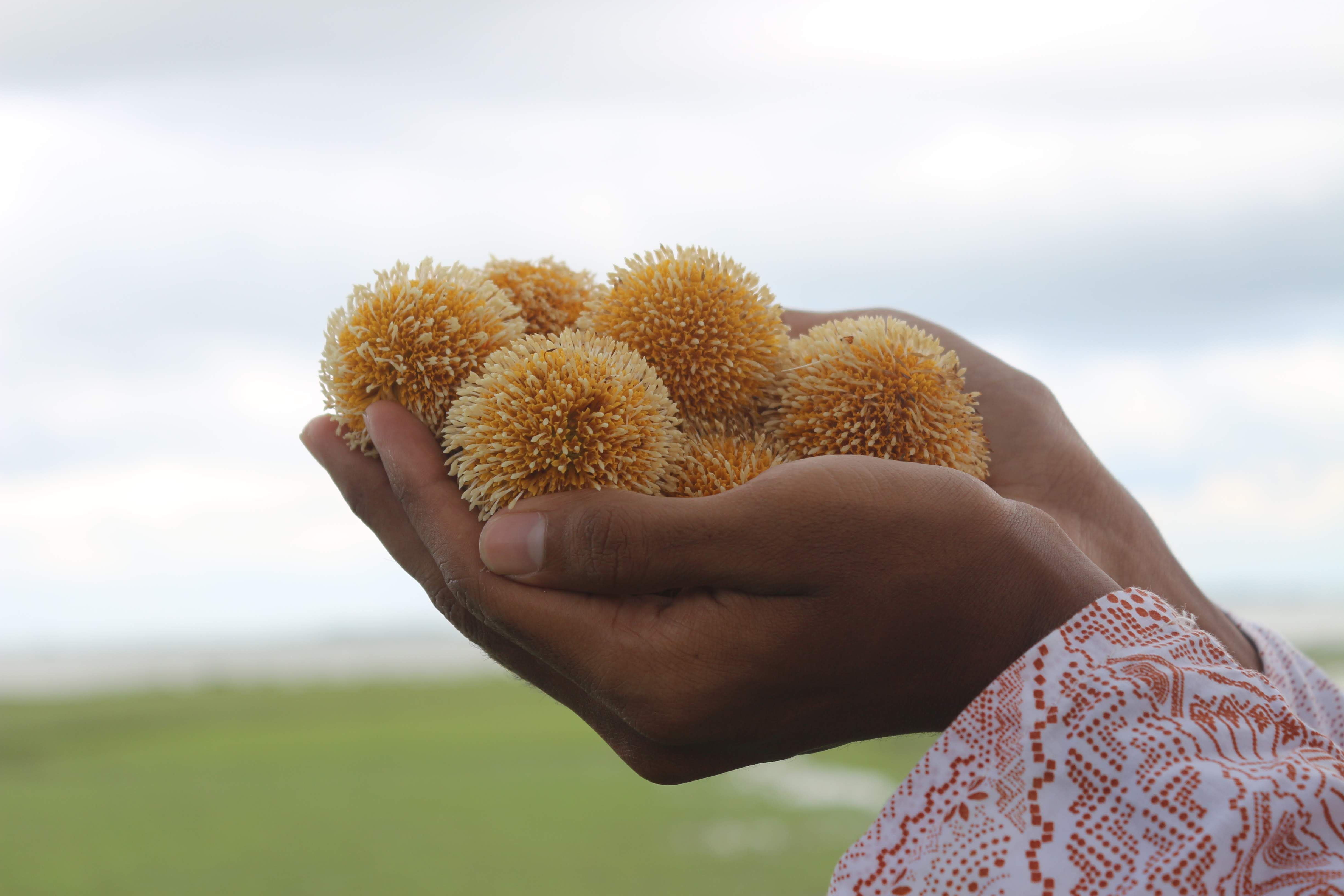 A person holds a handful of yellow spiky sea urchins against a blurred natural background.