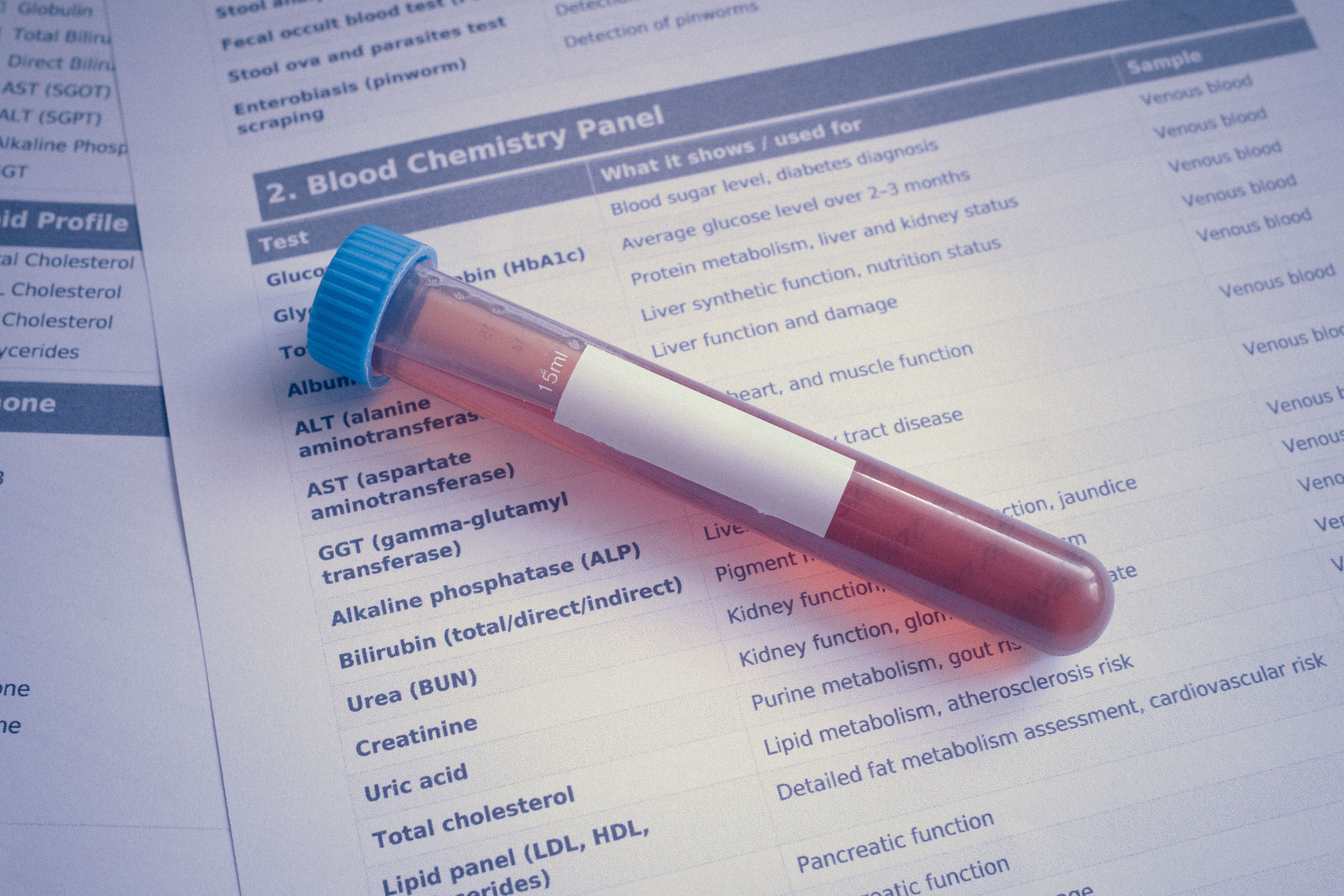 Simple urine test could improve kidney transplant decisions and save hundreds more donor kidneys