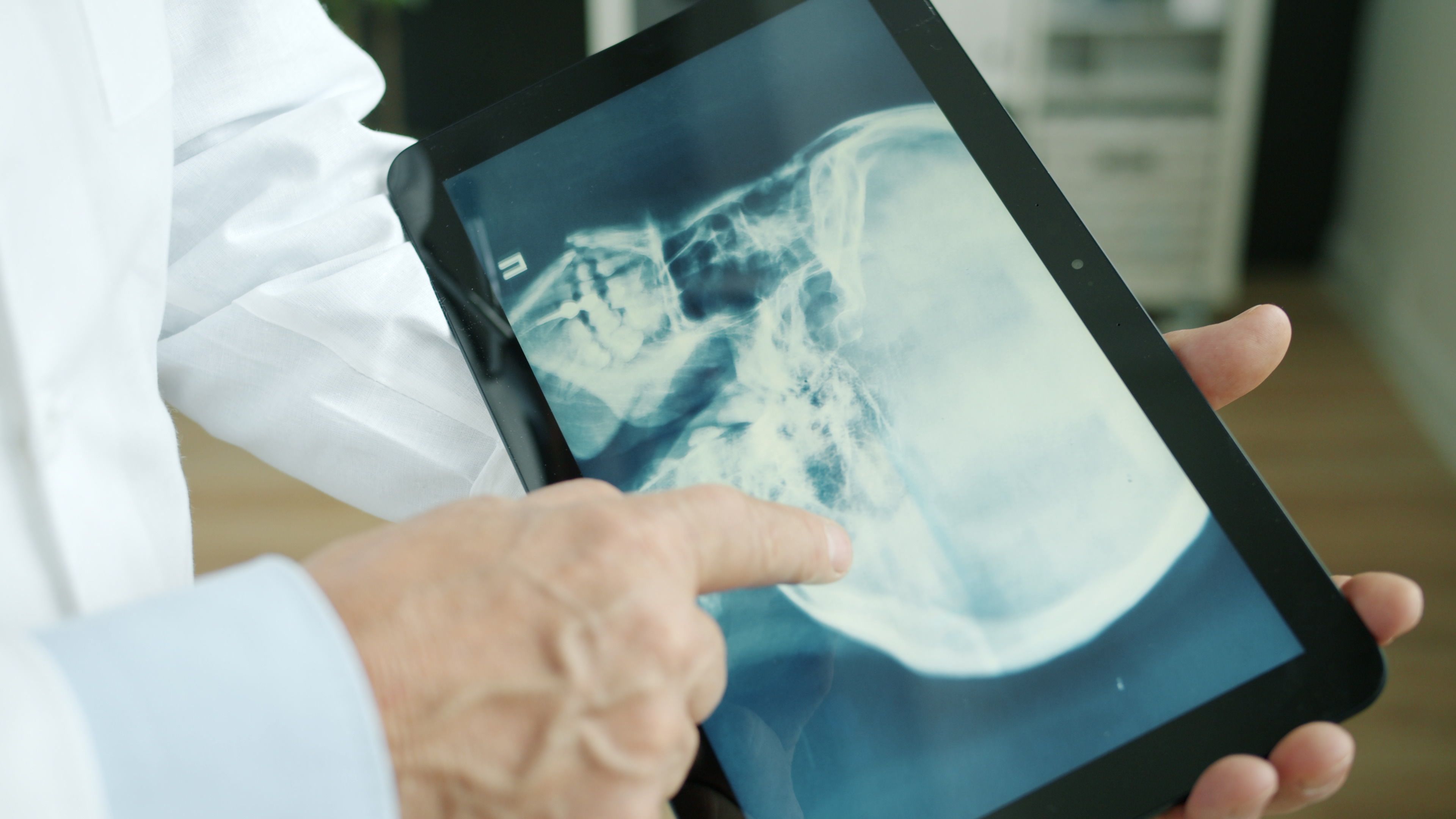 Female Pelvic Peritoneal Adhesions: Pathophysiology, Symptoms, and Surgical Management