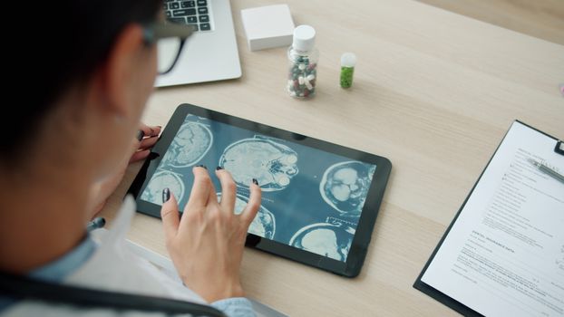 Doctor analyzing brain scans on a tablet in a clinical setting.