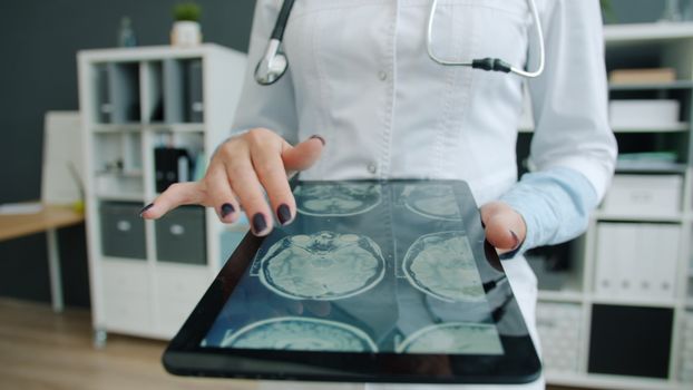 Doctor reviewing digital brain scans on a tablet in a medical office setting.