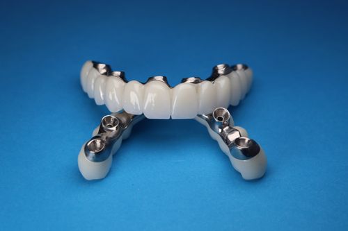 Free Close-up of dental implant prosthetics on a vivid blue background, showcasing precision and dental technology. Stock Photo