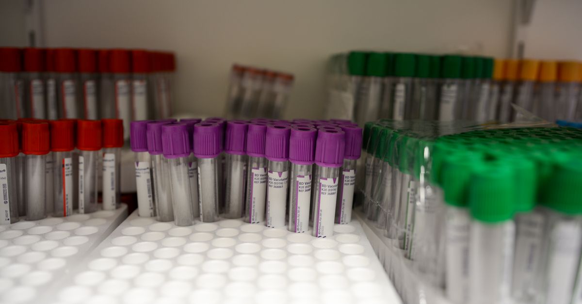 Close-up of labeled blood collection tubes in a laboratory with red, purple, and green caps.