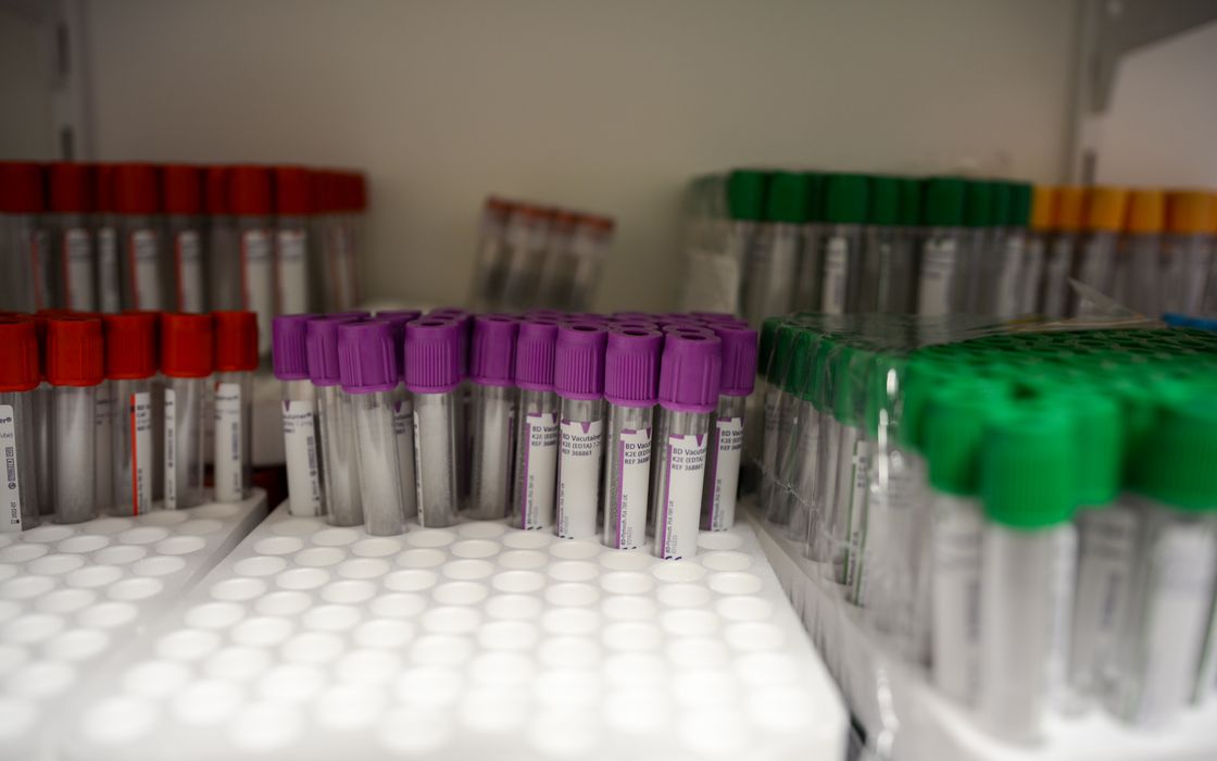 Rows of labelled blood collection tubes with red, purple and green caps in a laboratory