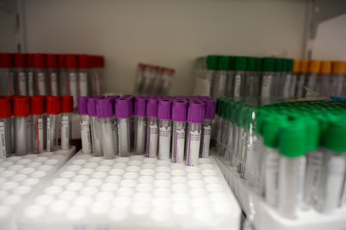 Free Close-up of labeled blood collection tubes in a laboratory with red, purple, and green caps. Stock Photo
