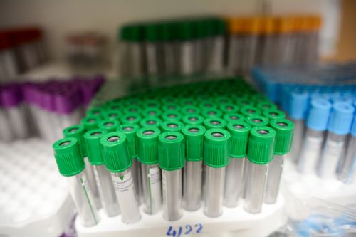 Free Multiple blood test vials arranged neatly in a medical lab setting, highlighting organization. Stock Photo