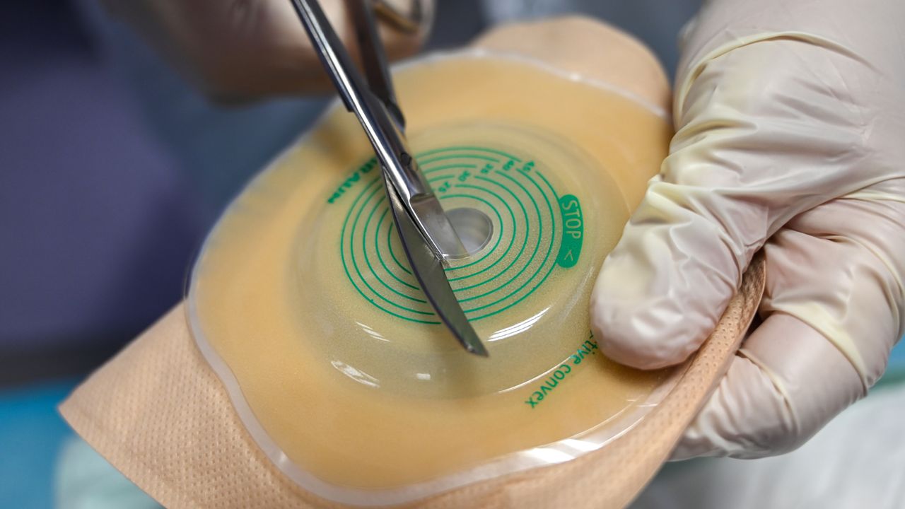 Micropigmentação Capilar em São Paulo: Recupere a Densidade Visual com Expertise - Augusta Perfection