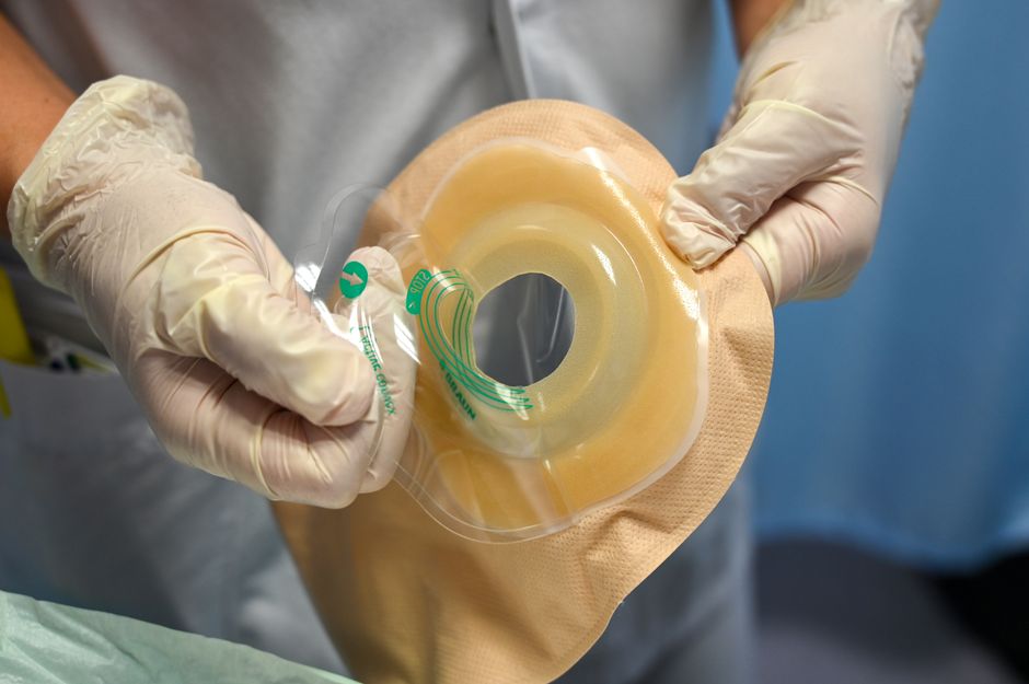 Close-up of a nurse wearing gloves while handling an ostomy pouch in a clinical environment.