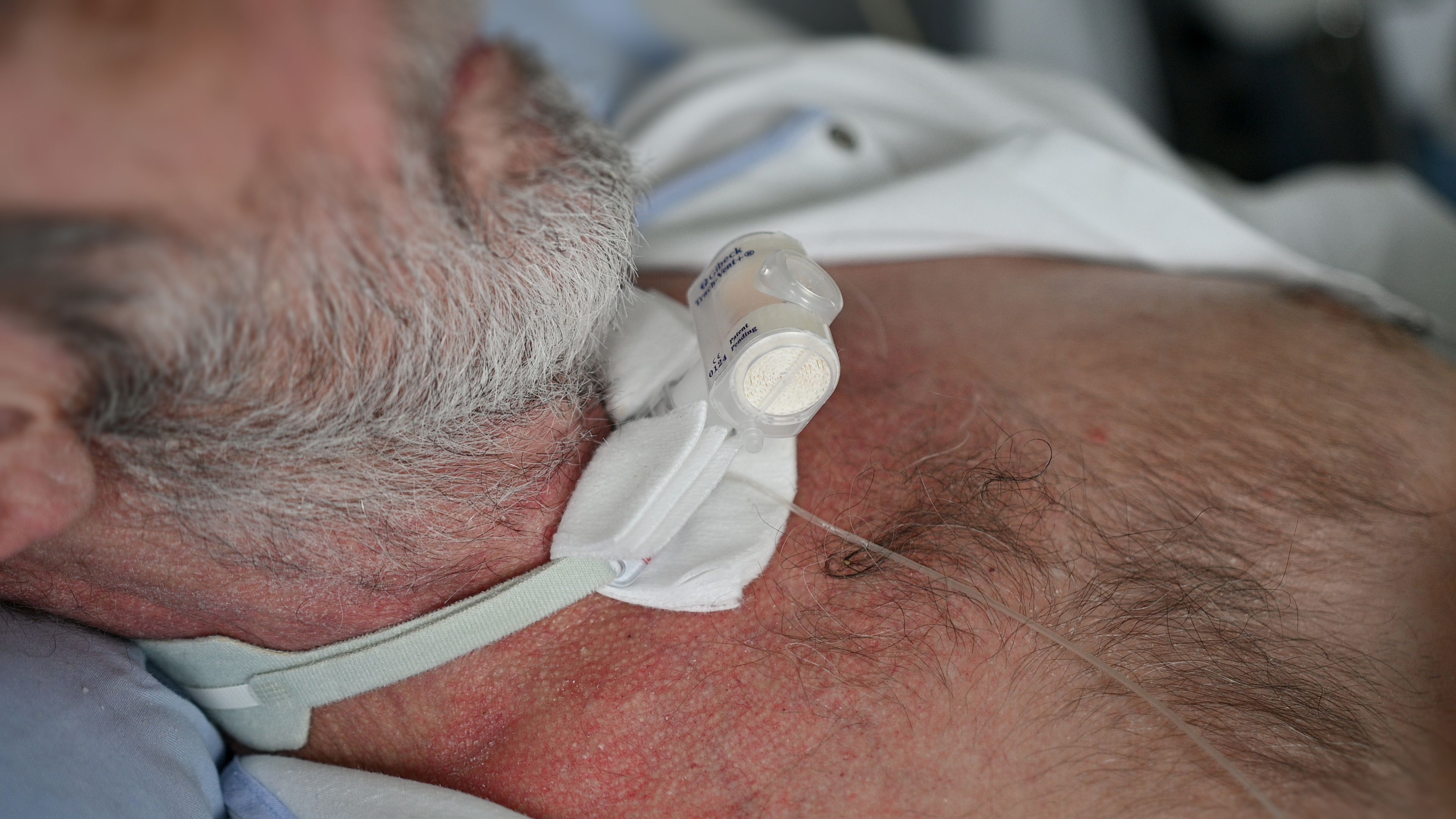 Un mort și un rănit grav la o mofetă neautorizată din Harghita