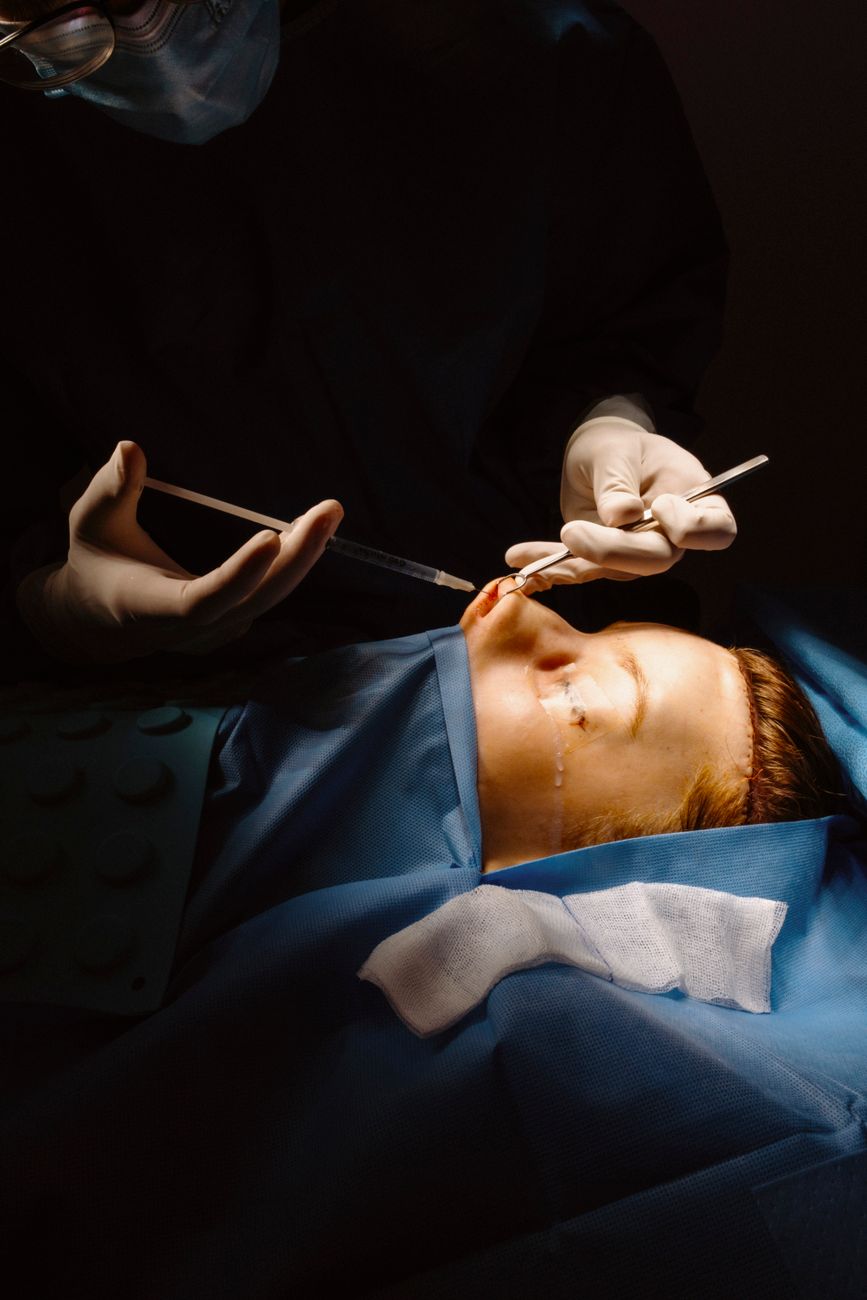 Un chirurgien réalise avec précision une chirurgie plastique du visage dans un bloc opératoire stérile.