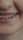 dental smile