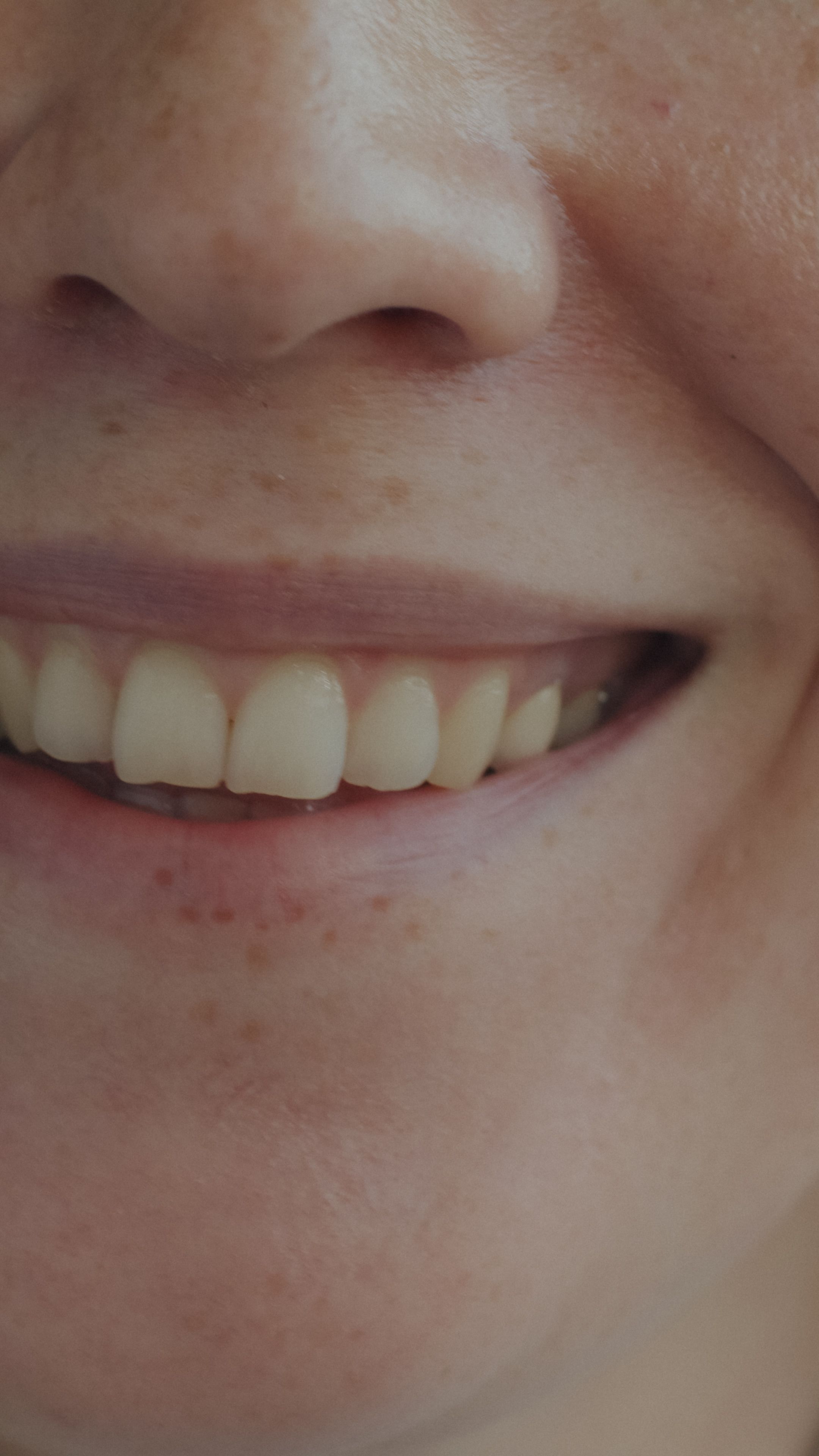 Primer plano de una sonrisa natural y saludable
