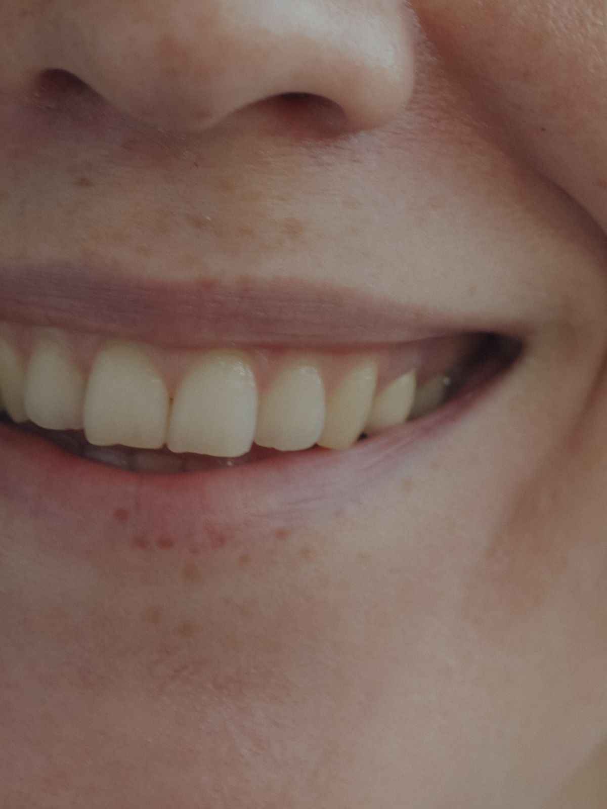 Primer plano de una sonrisa natural y saludable