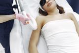 Laser hair removal session