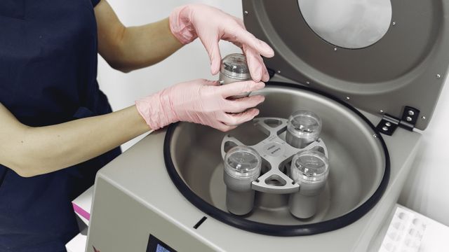 Preenchimento Código de Barras em Jundiaí: O Guia Completo para Rejuvenescimento Labial - Augusta Perfection