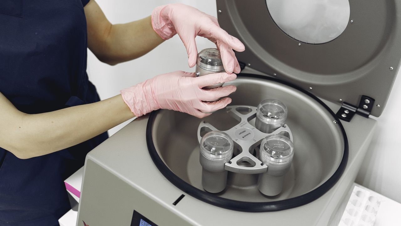 Preenchimento Código de Barras em Jundiaí: O Guia Completo para Rejuvenescimento Labial - Augusta Perfection