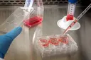 Allogeneic NK Cell Therapy: How Microfluidic Gene Delivery Speeds Up Cancer Immunotherapy