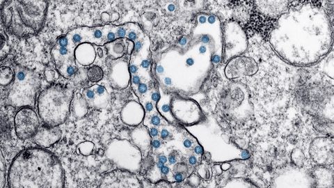 Extracellular vesicles: real biology arriving well ahead of credible products
